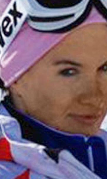 Russian skier Komissarova has second surgery on fractured spine